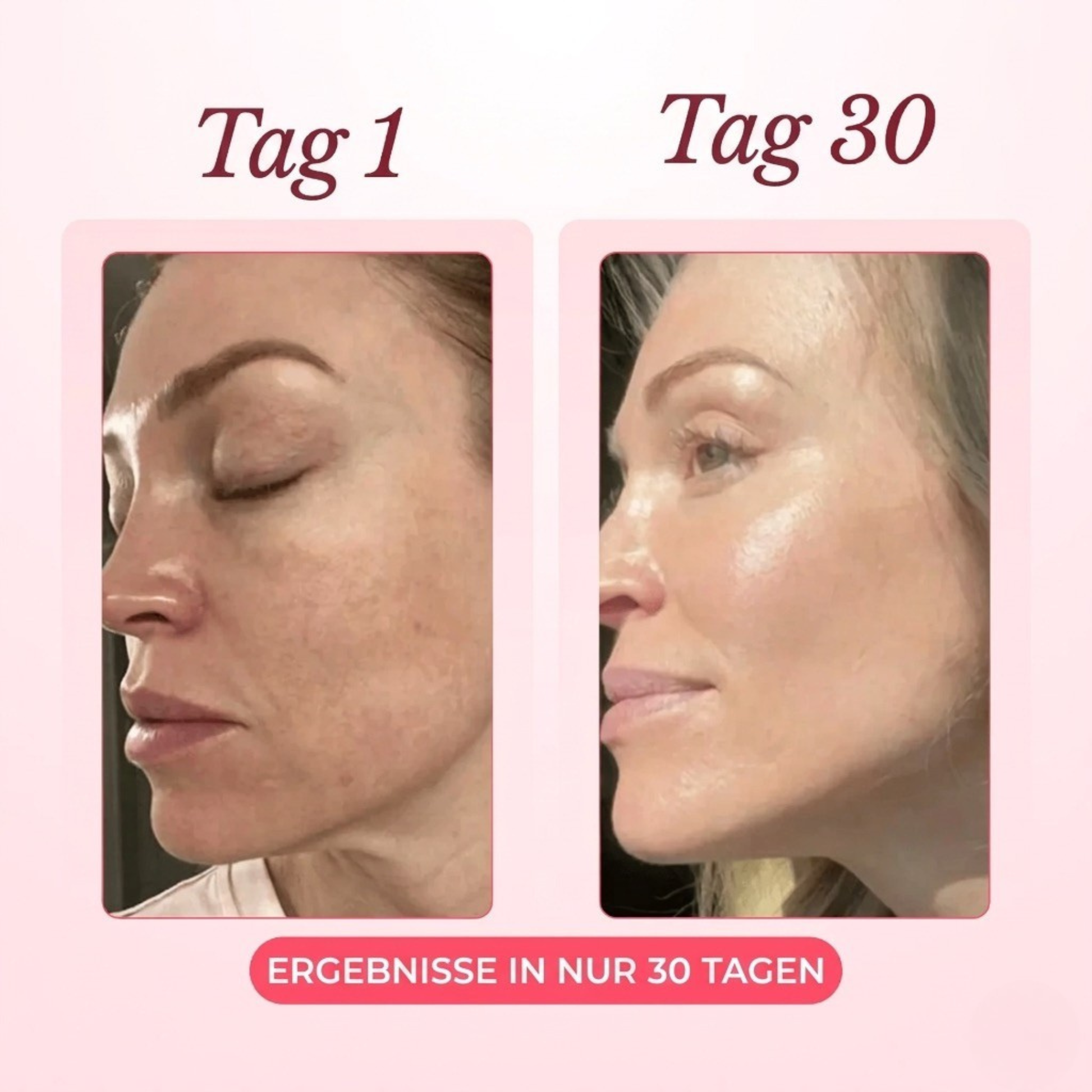 Vorher Nachher Ergebnis – Tag 1 vs Tag 30