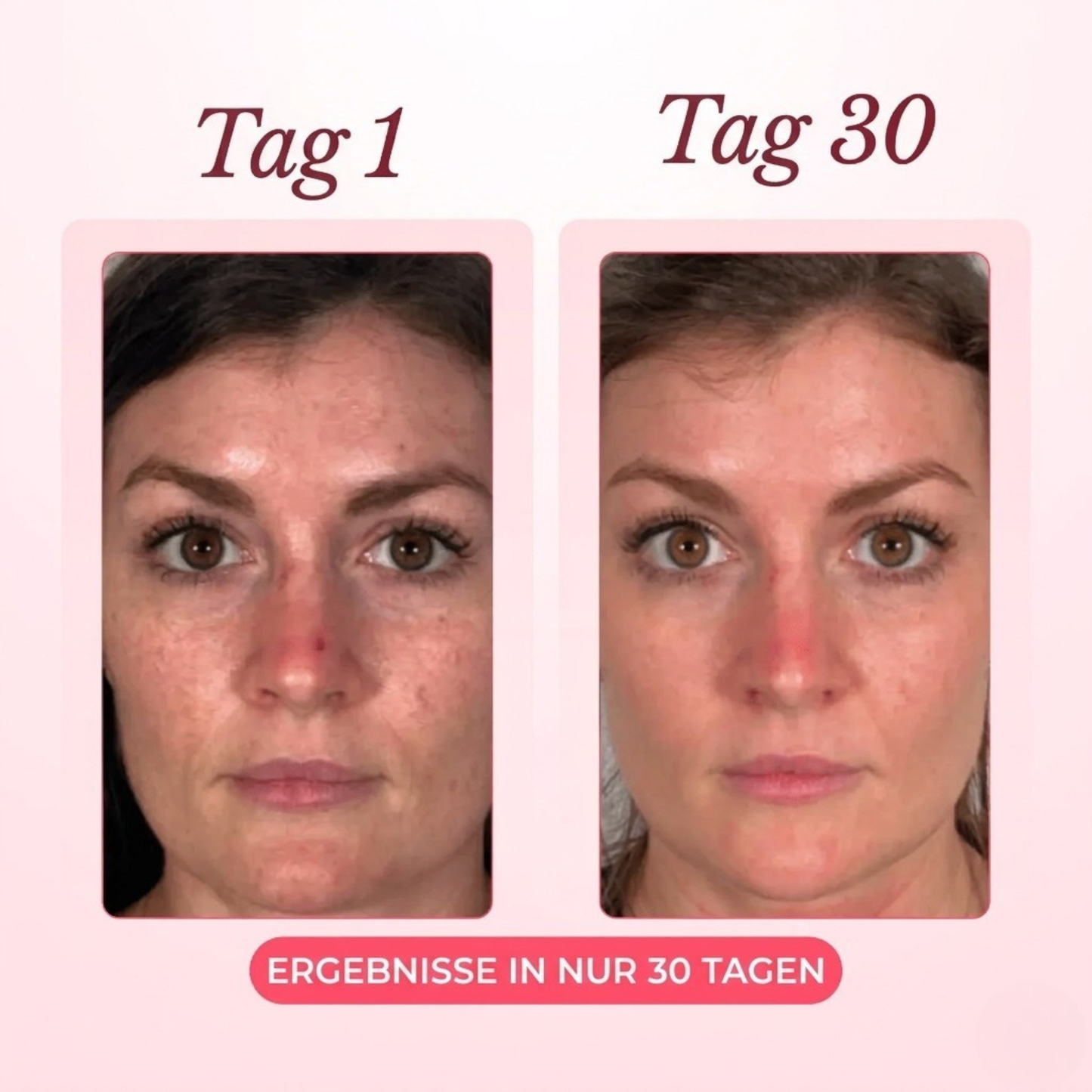 Vorher Nachher Ergebnis – Tag 1 vs Tag 30
