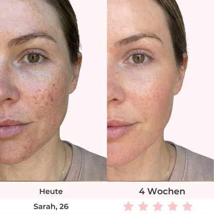 LuxyGlow 7-in-1 Hals- & Gesichtspflege