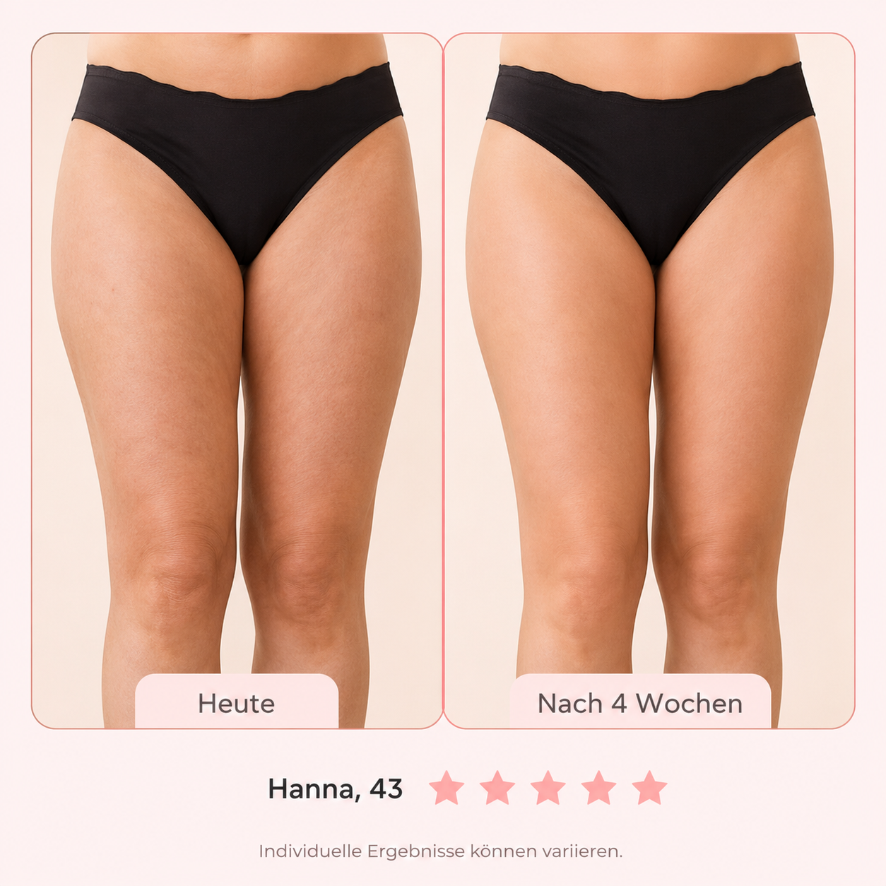 luxyshape-13-vorher-nachher-hanna.png