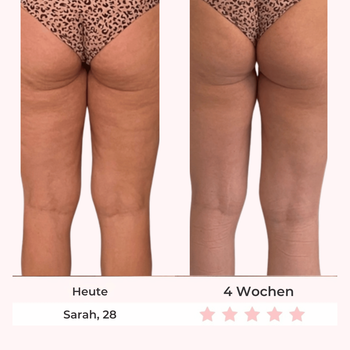 Vorher Nachher - Sarah 28