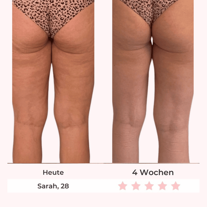 Vorher Nachher - Sarah 28